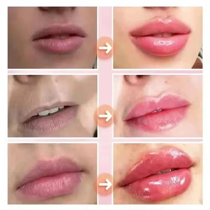 Instant Lip Plumping Essential - Lip Gloss Plumping ulasan dan harga